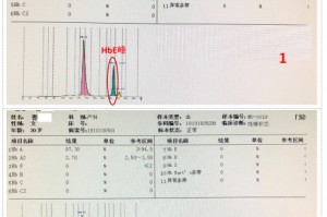 dnf红眼免疫异常_血红蛋白免疫异常